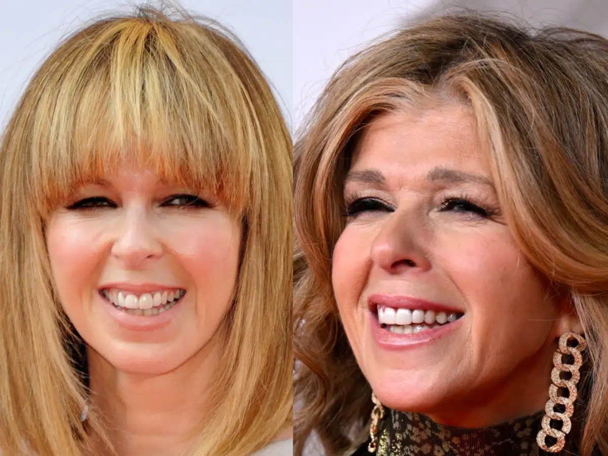 kate garraway teeth before after