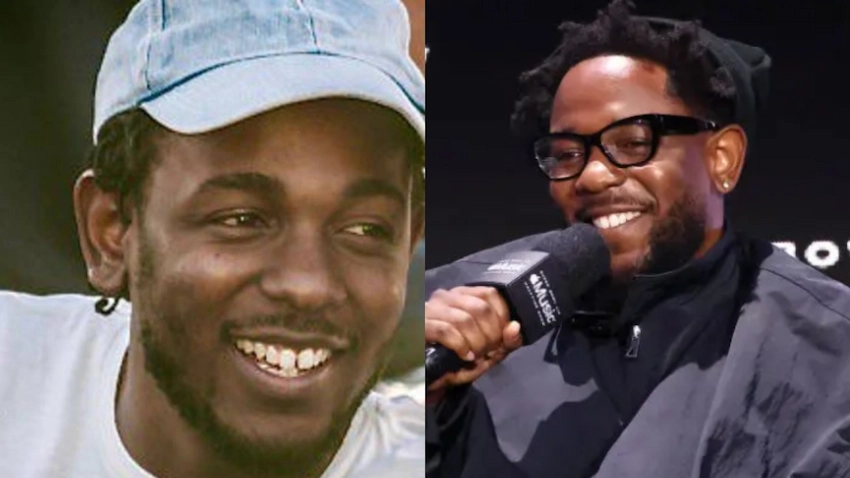kendrick lamar teeth before after