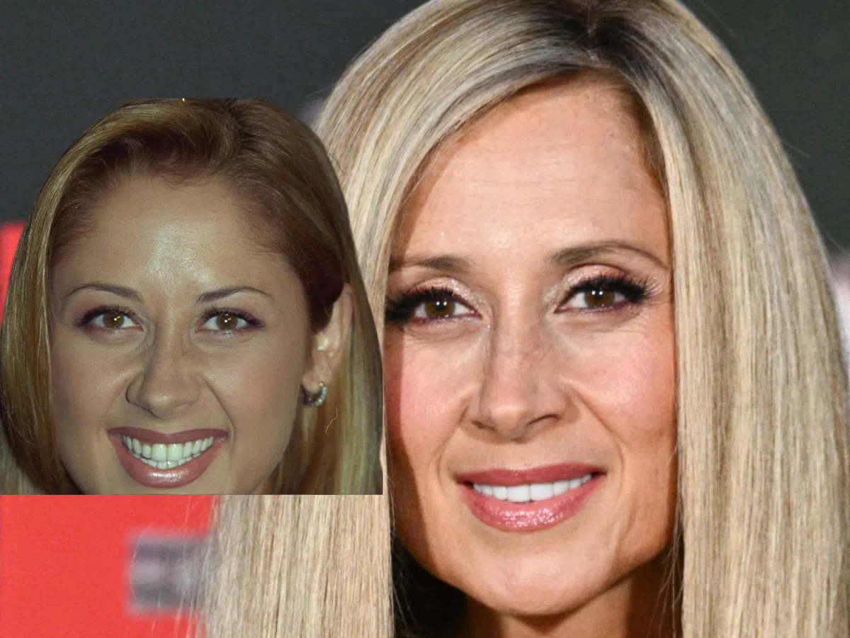 lara fabian teeth before after