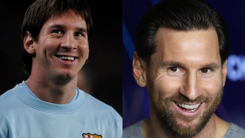 lionel messi teeth before after