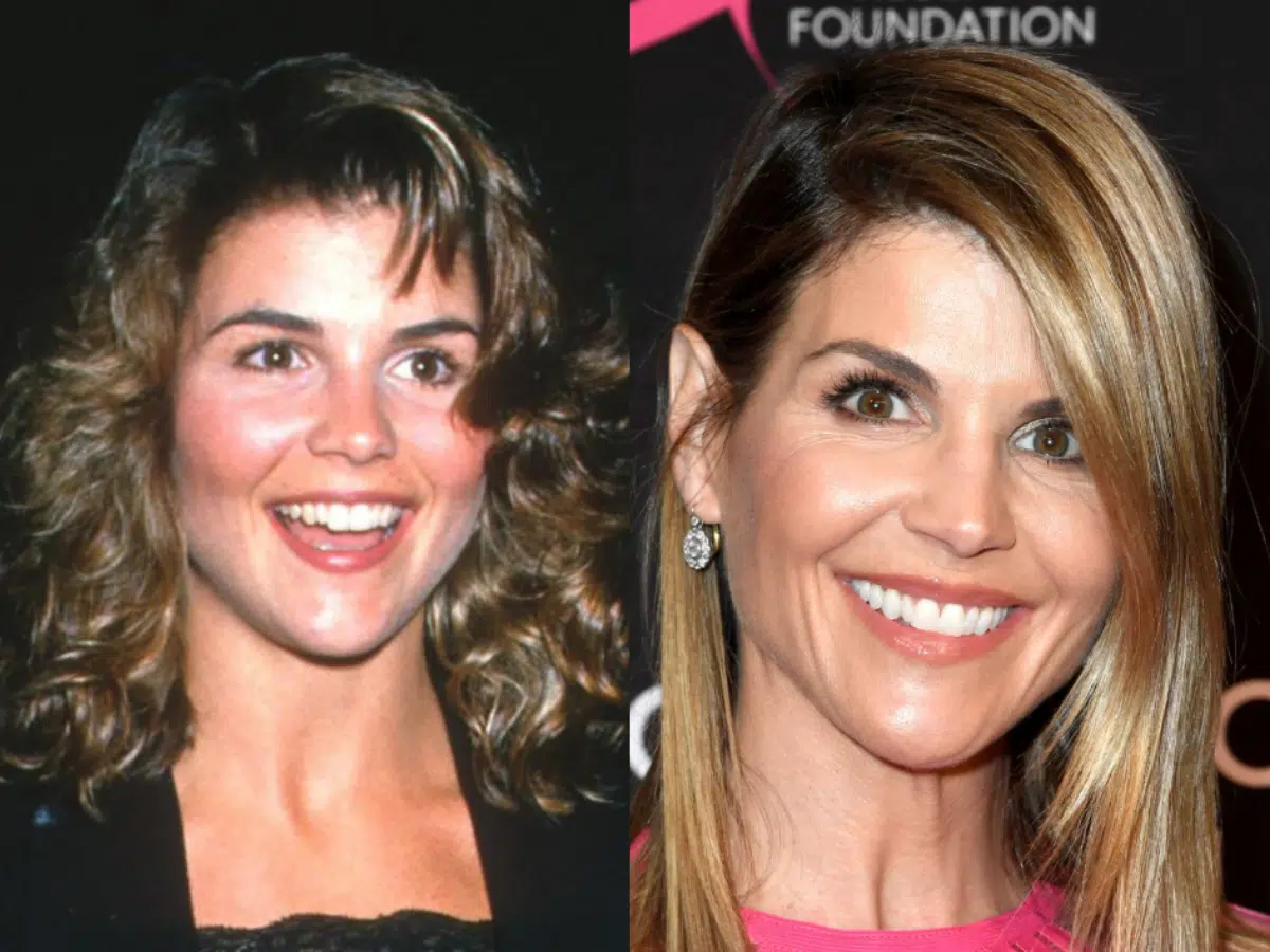lori loughlin teeth before after