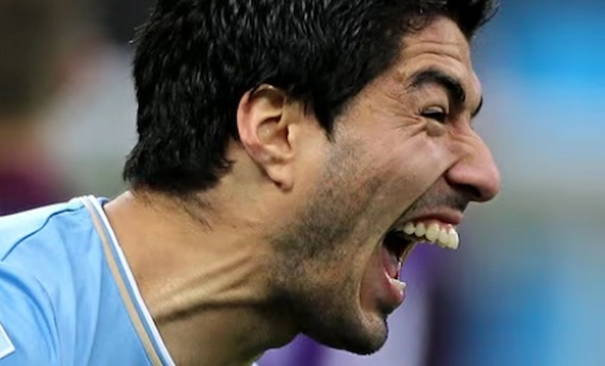 luis suarez teeth