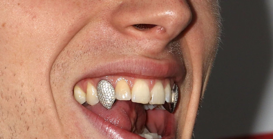 серебряные зубы machine gun kelly