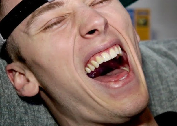 зубы machine gun kelly в 2010 году