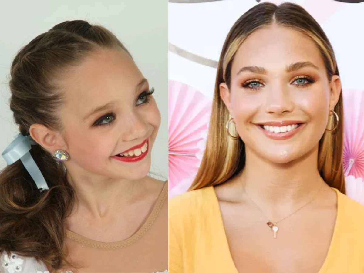 maddie ziegler teeth before after