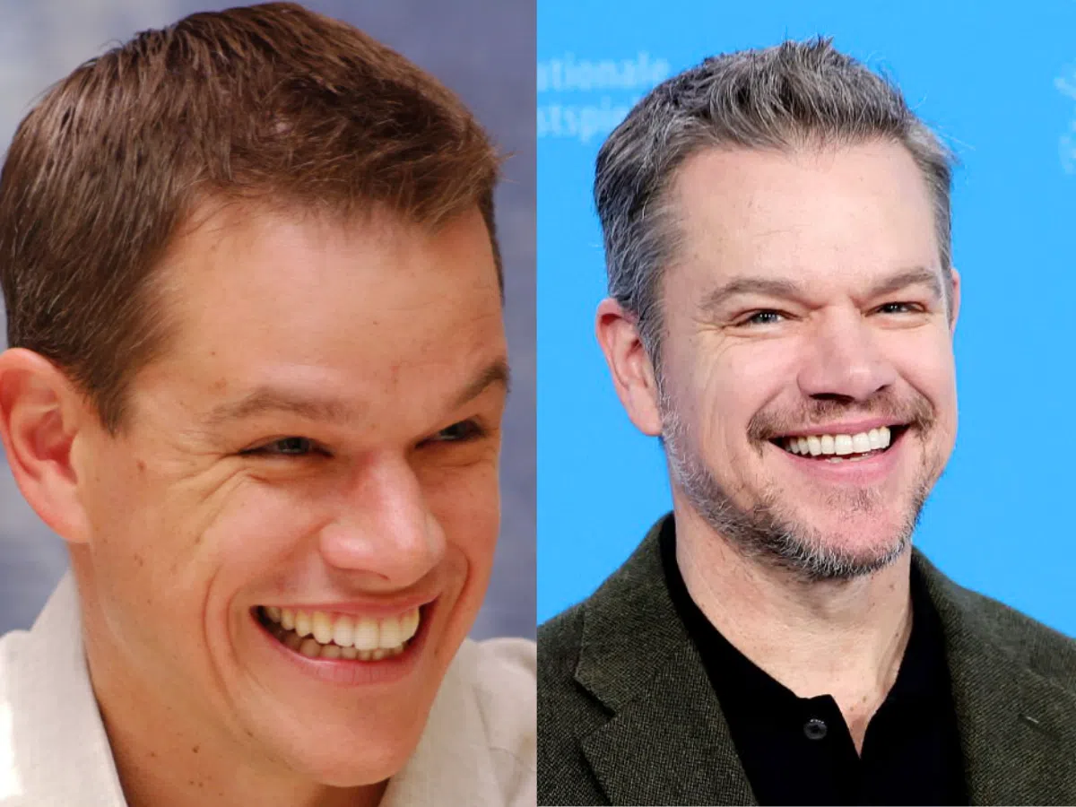 matt damon teeth before after