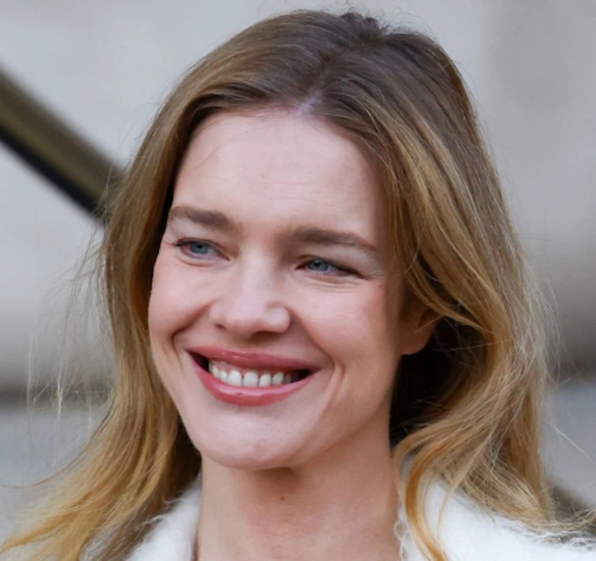 natalia vodianov teeth 2025