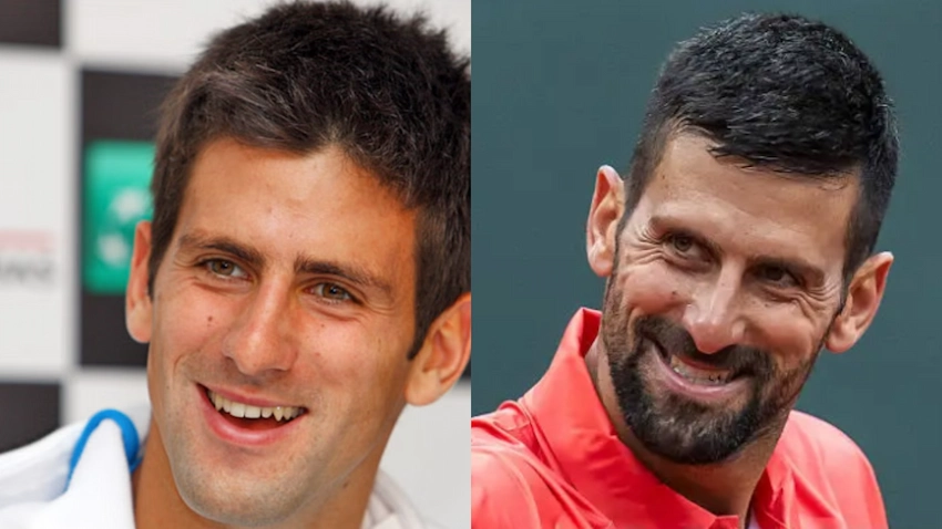 novak djokovic teeth before after