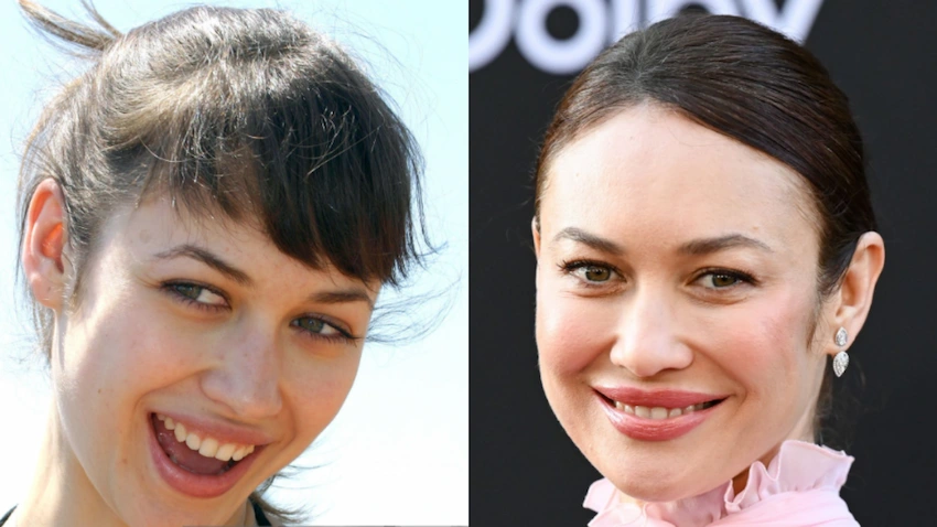 olga kurylenko teeth before after