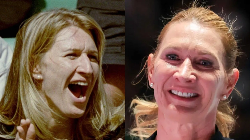 steffi graf teeth before after