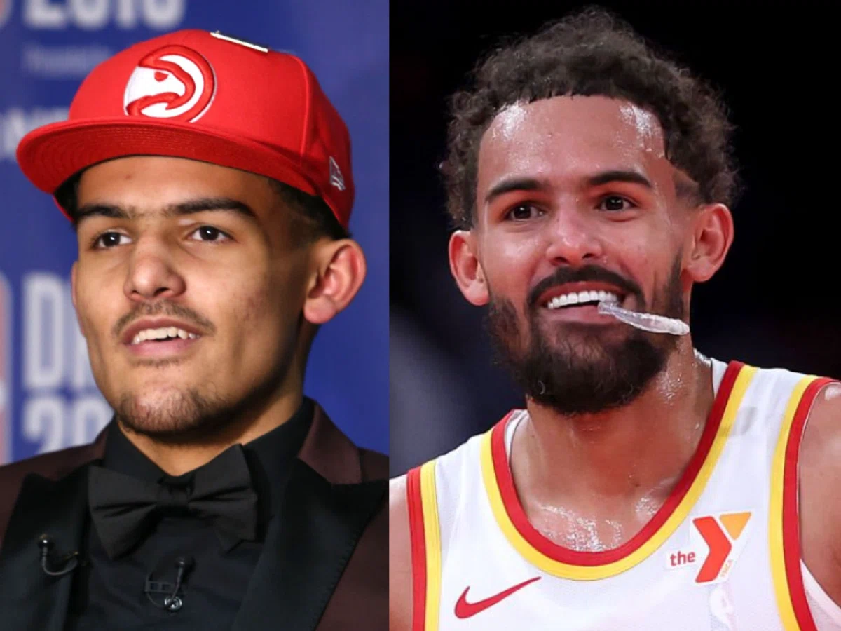 trae young teeth before after