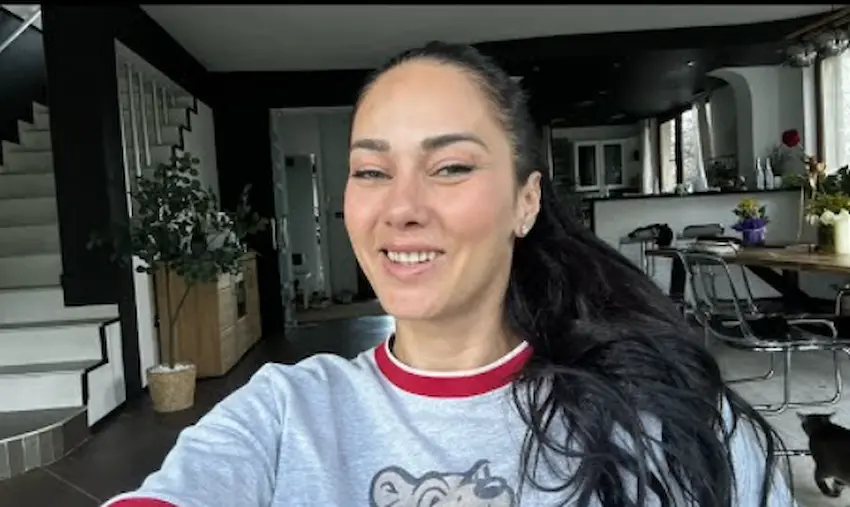 yoanna yokko teeth 2025s
