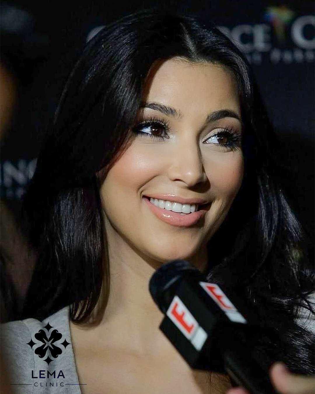 Kim Kardashian зъби