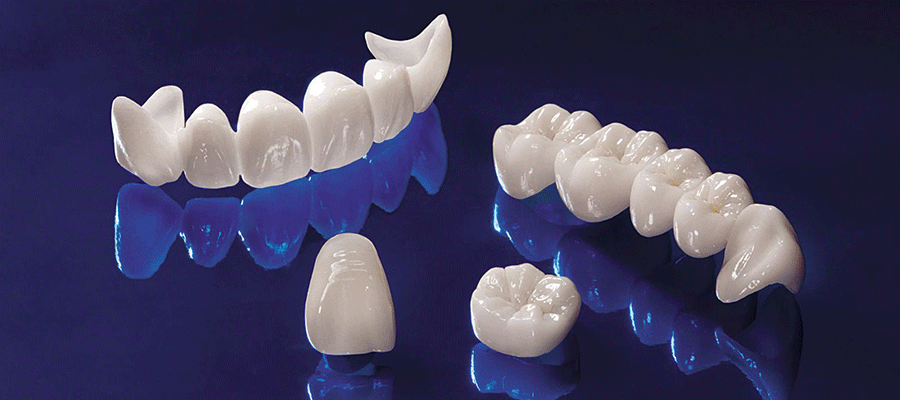 Dental Crown Procedure: What To Expect