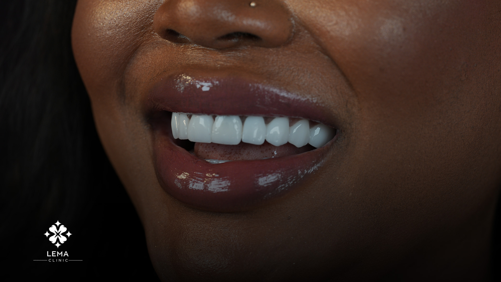danan las implantes dentales