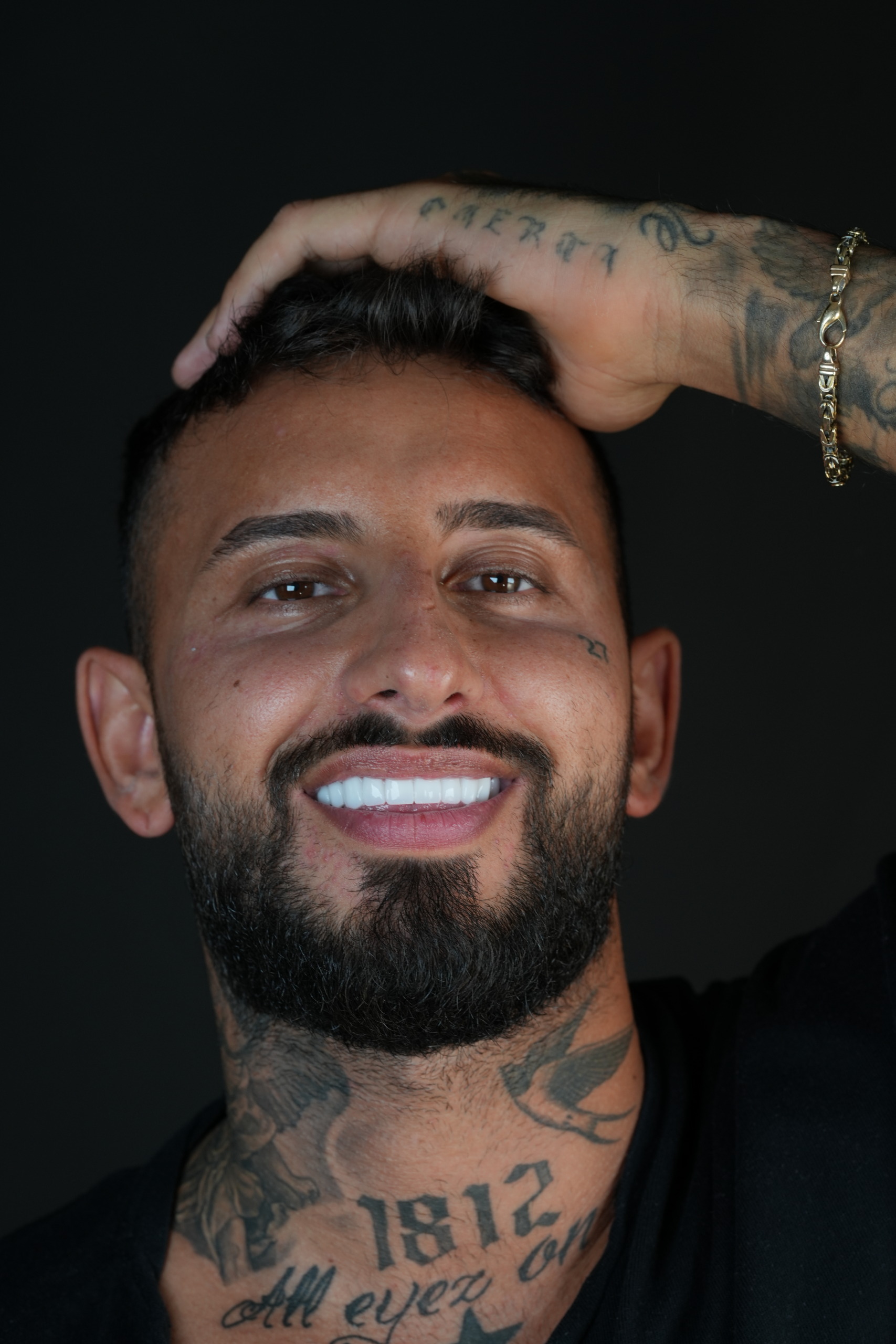 De ce Fatete Dentare