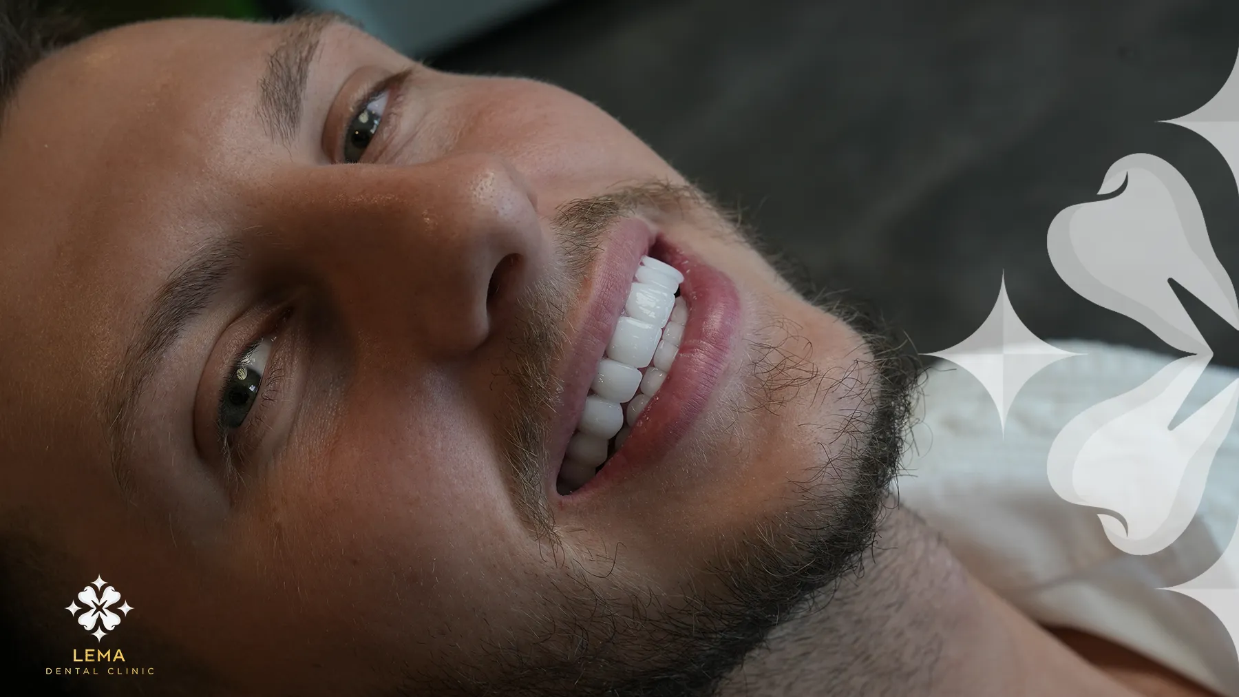 es seguro el tratamiento de blanqueamiento dental