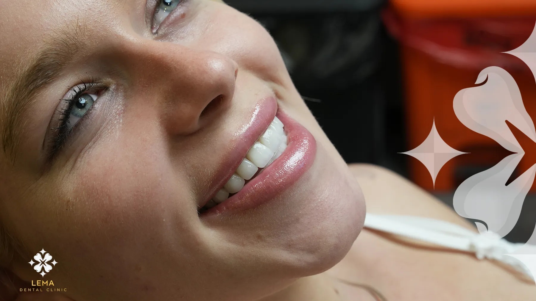 guide de soins apres implant dentaire