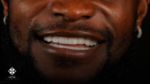 hollywood smile sfaturi de intreprindere