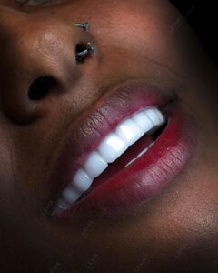 hollywood sorriso