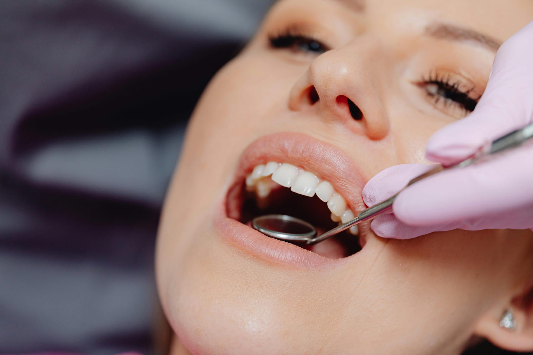 how-long-after-a-filling-can-you-eat