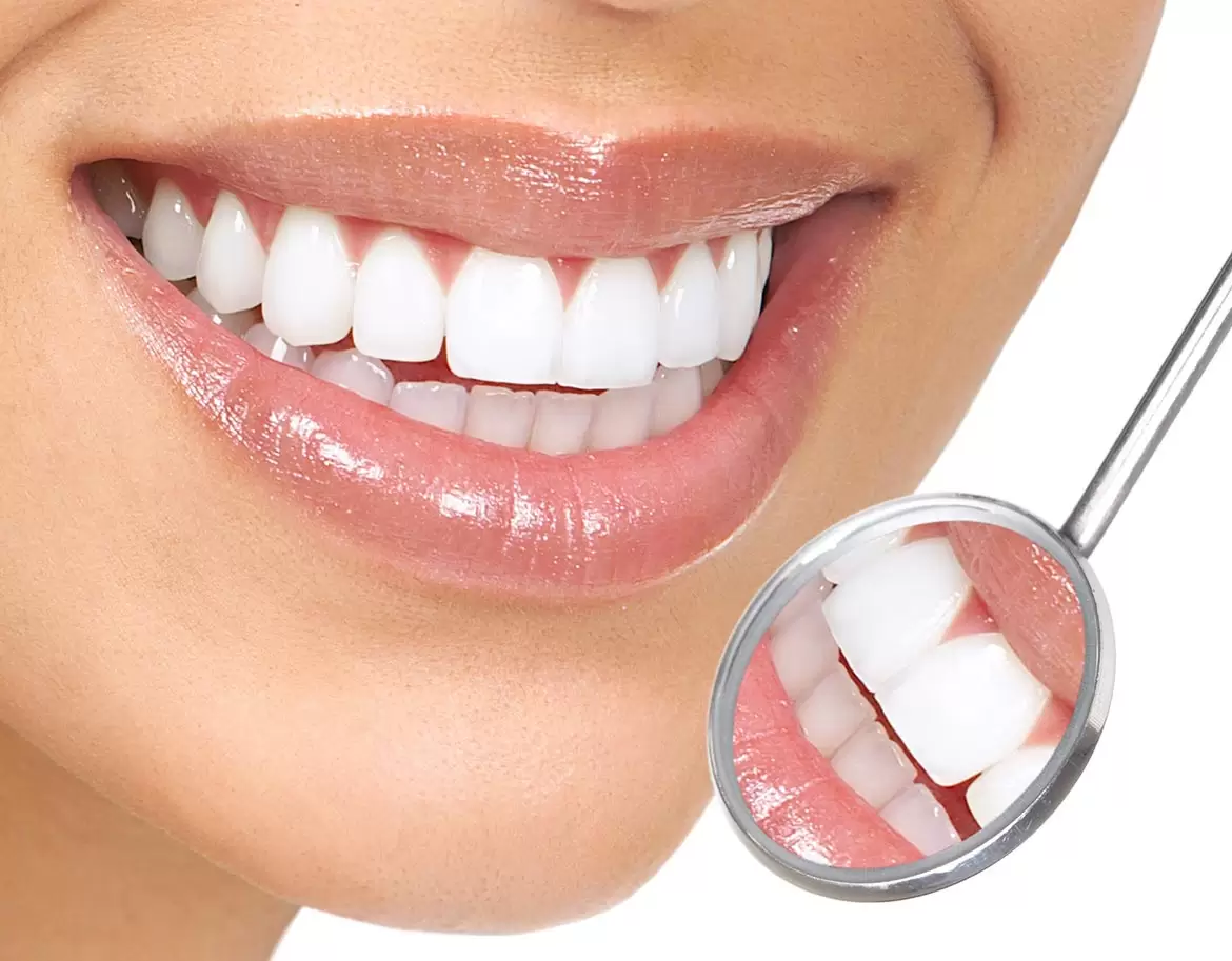 Comparing Dental Veneers Cost