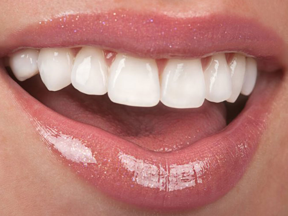 Understanding And Treating Buckteeth