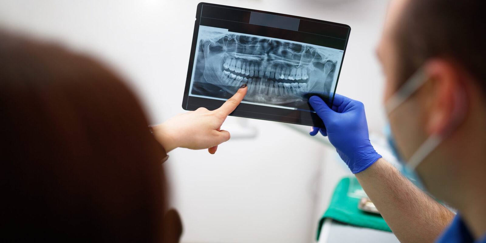 radiografie-dentara2