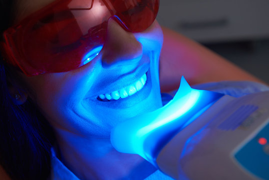 Teeth Whitening London vs Istanbul