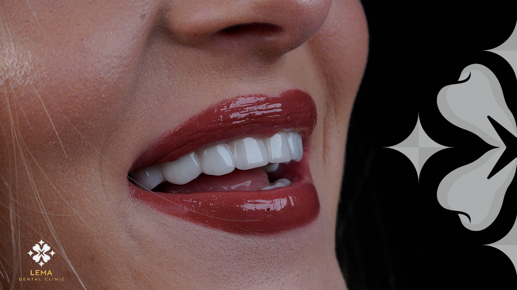 tratament implantul dentar