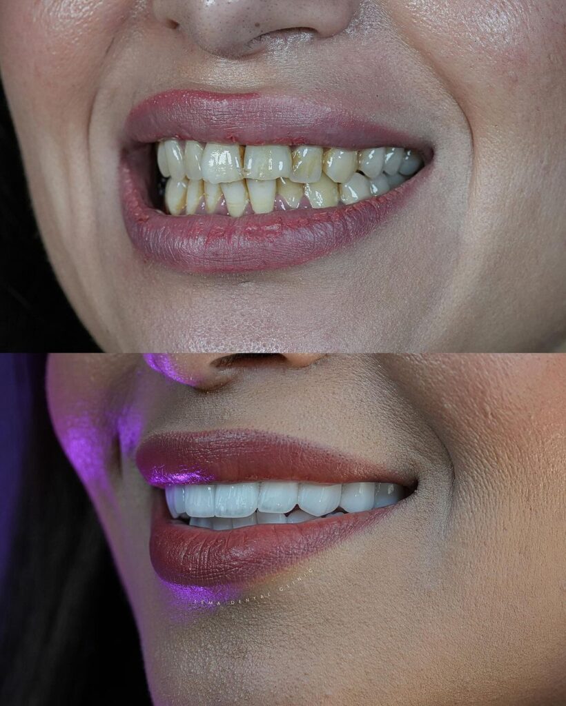 lema dental clinic
