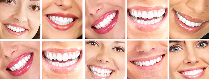 How Many Teeth Do Adults Have?