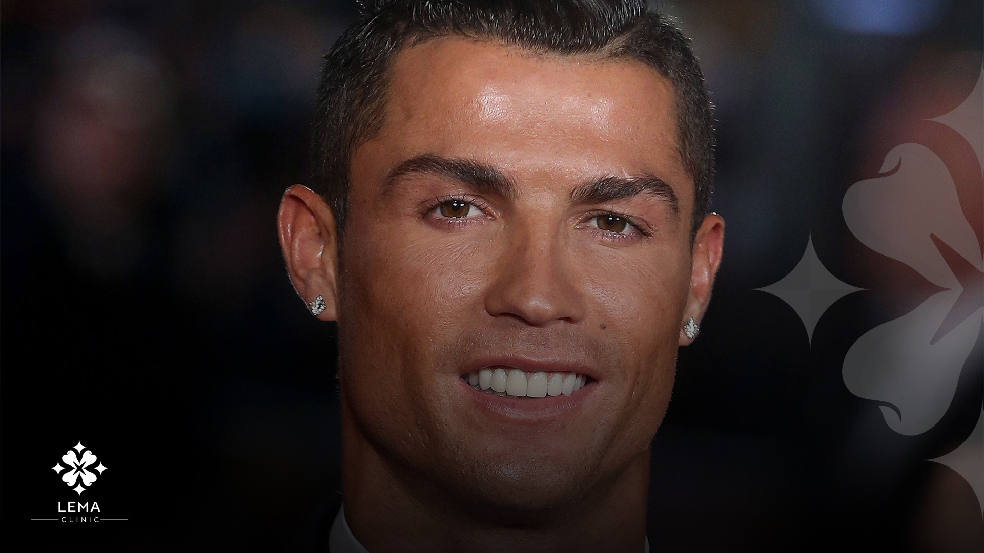 преобразование улыбки cristiano ronaldo